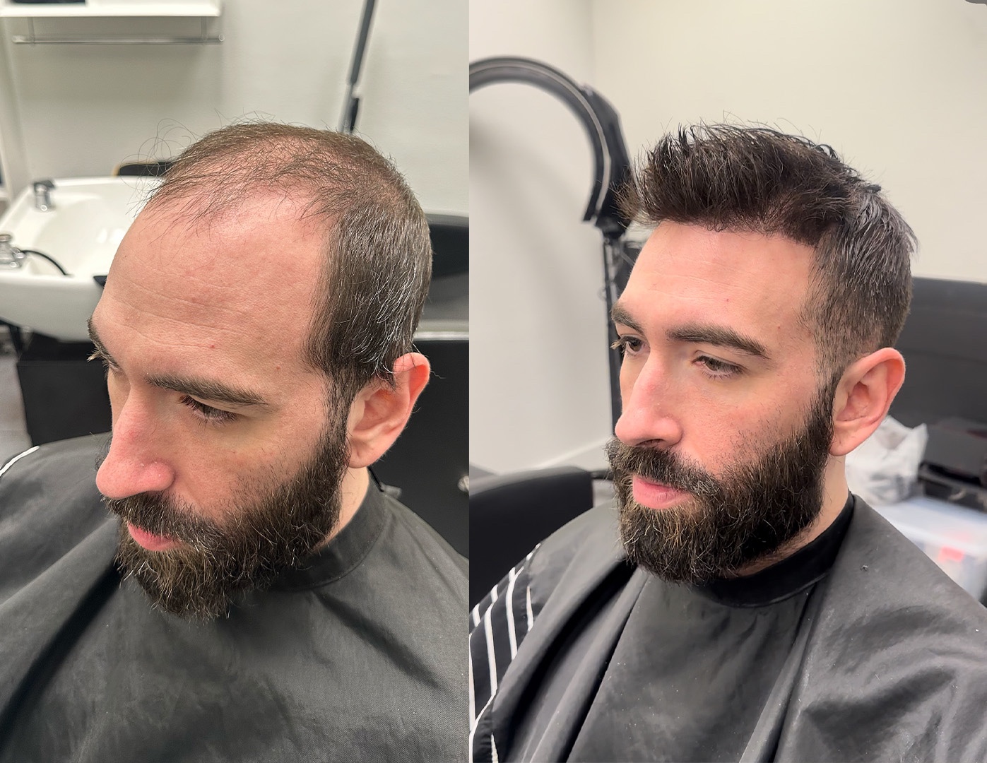 Hair system transformation showing fuller styled hair