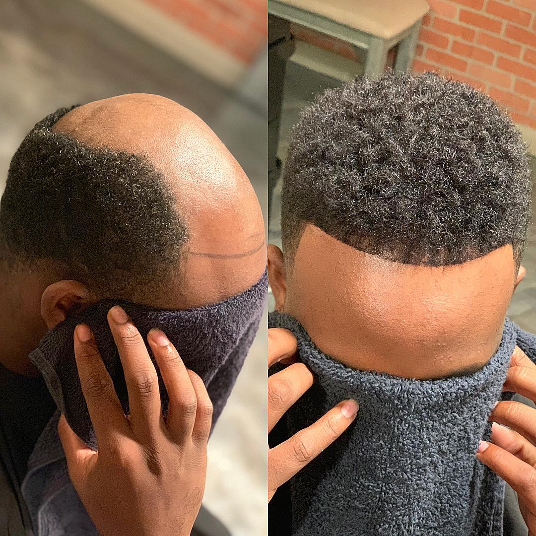 Hair replacement style inspiration for Bossier City, Louisiana
